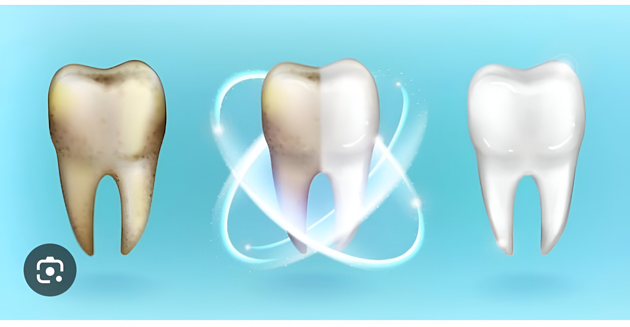 Clareamento dental com supervisão da Dra. Fabiola, Porto Alegre